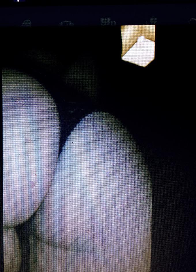 Escort 3662152884